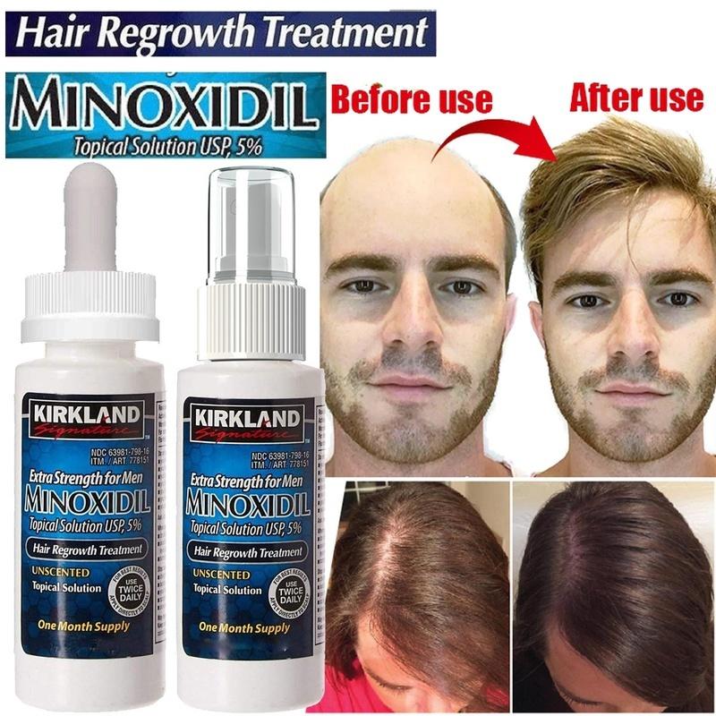 USA IMPORTED Kirkland Minoxidil 5% – Hair Regrowth Solution (60ml) - Image 3
